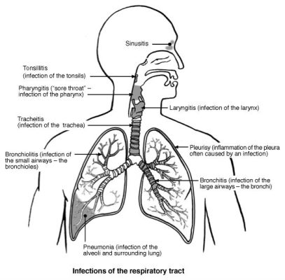 Hình mô tả một số bộ phận của phổi và các bệnh nhiễm trùng thường gặp