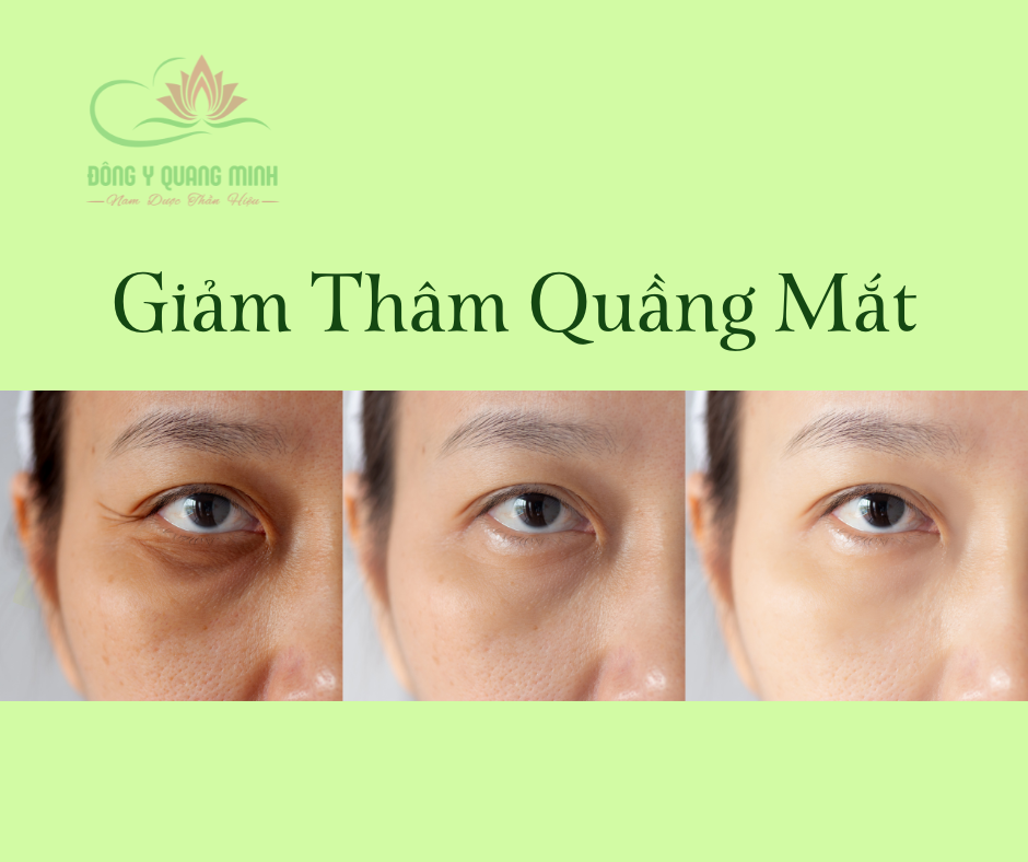 tác dụng của trà xanh
