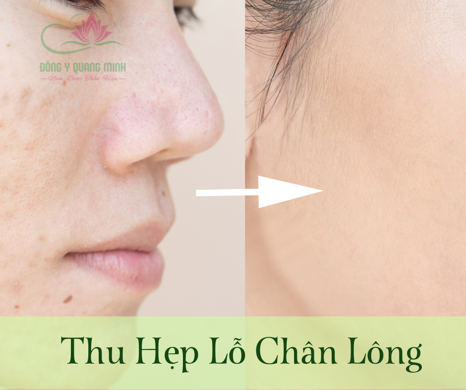 tác dụng của trà xanh