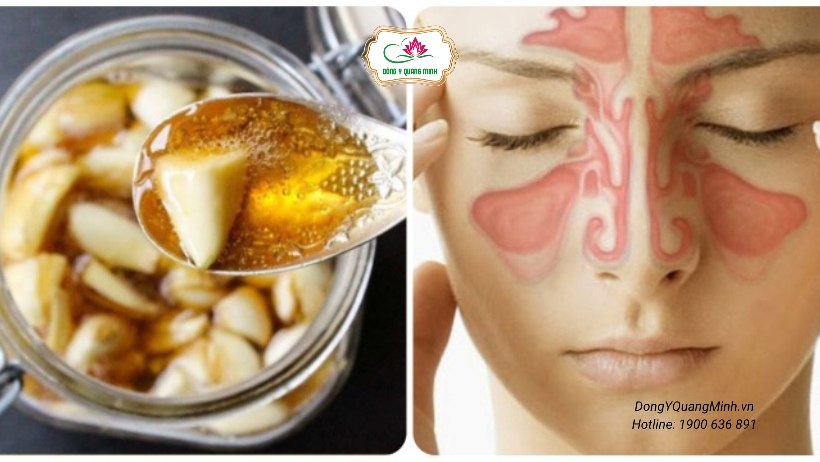 tác dụng tỏi ngâm mật ong