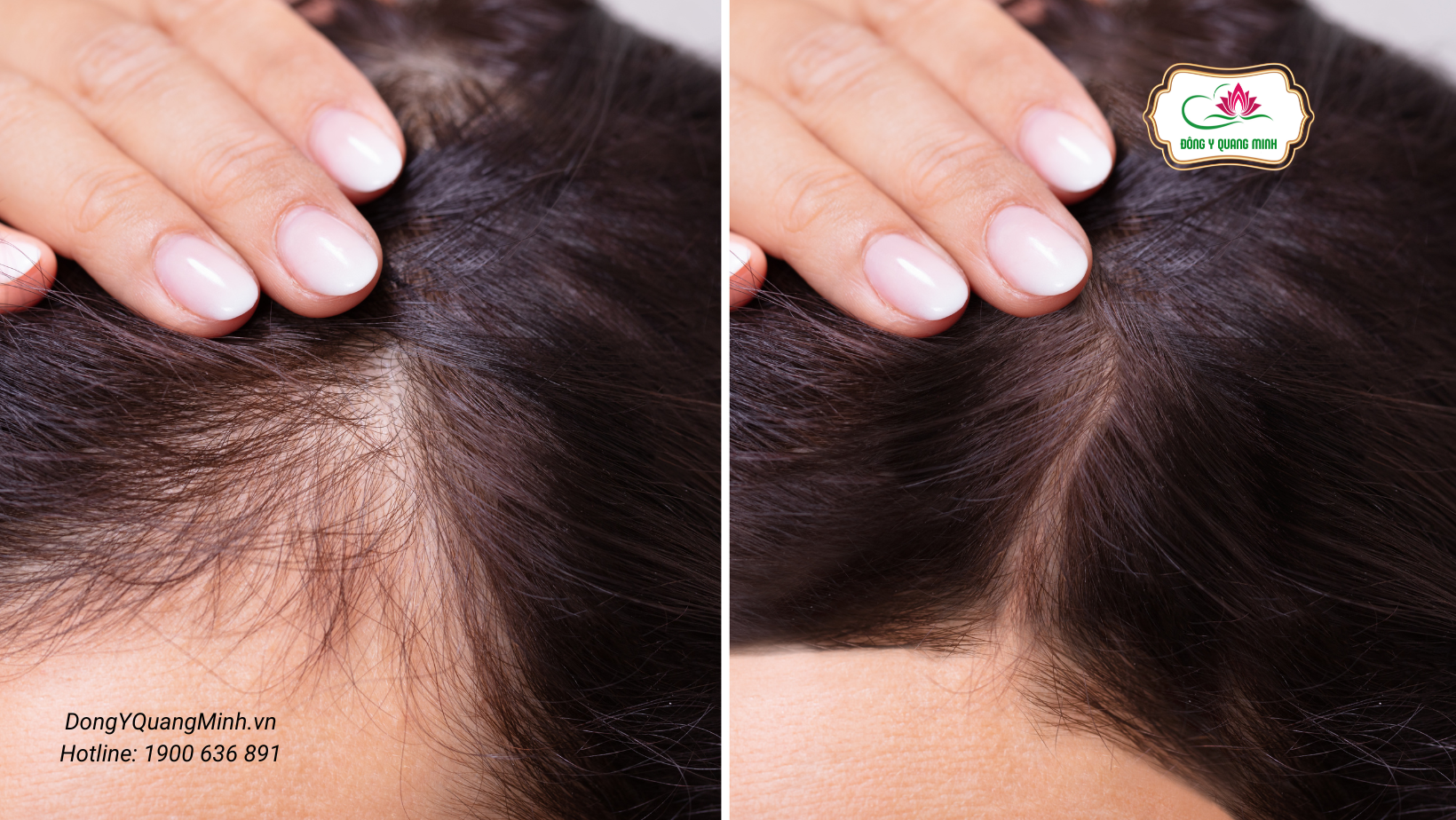 tác dụng tỏi ngâm mật ong