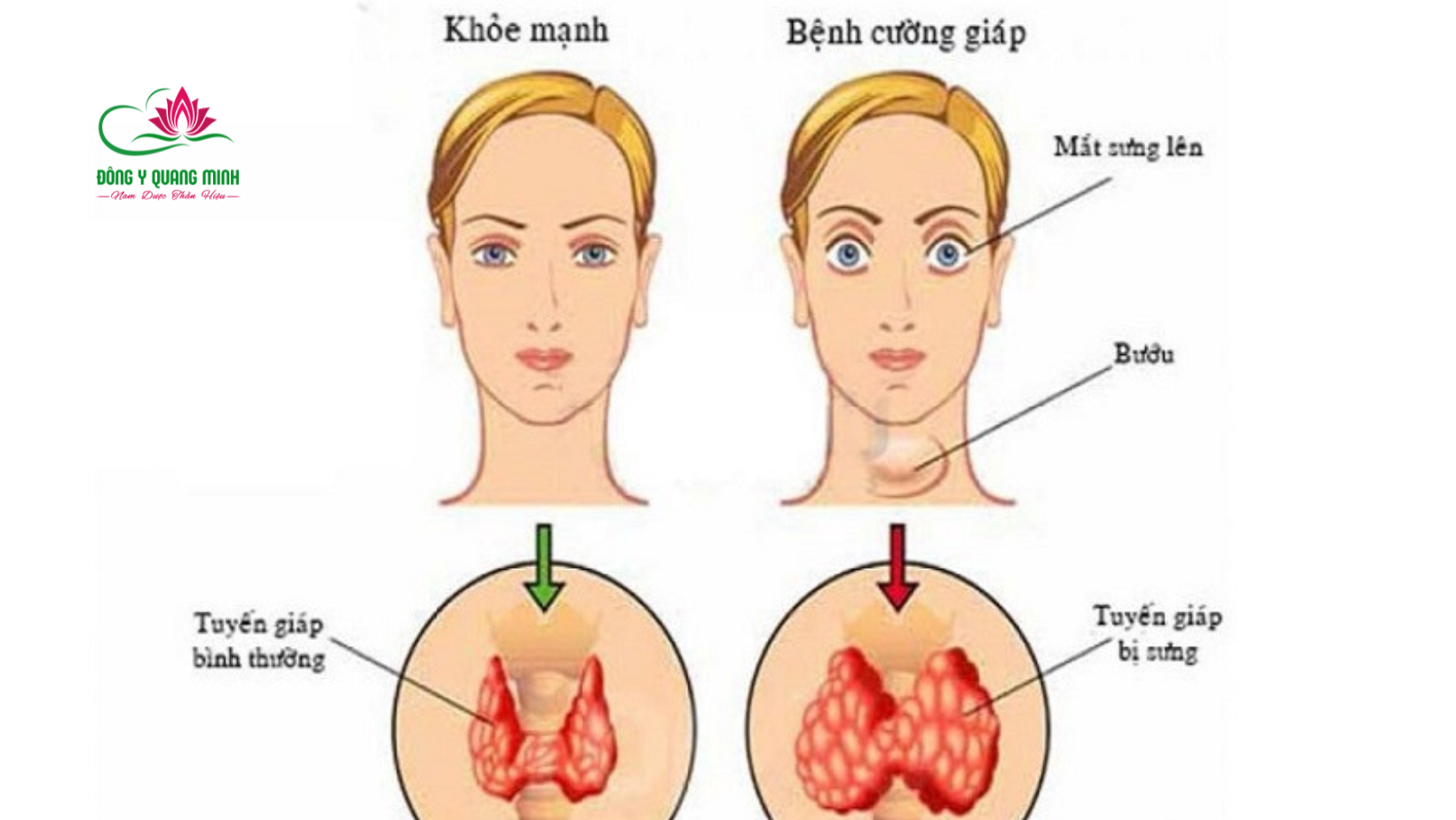 Giải phẫu tuyến giáp