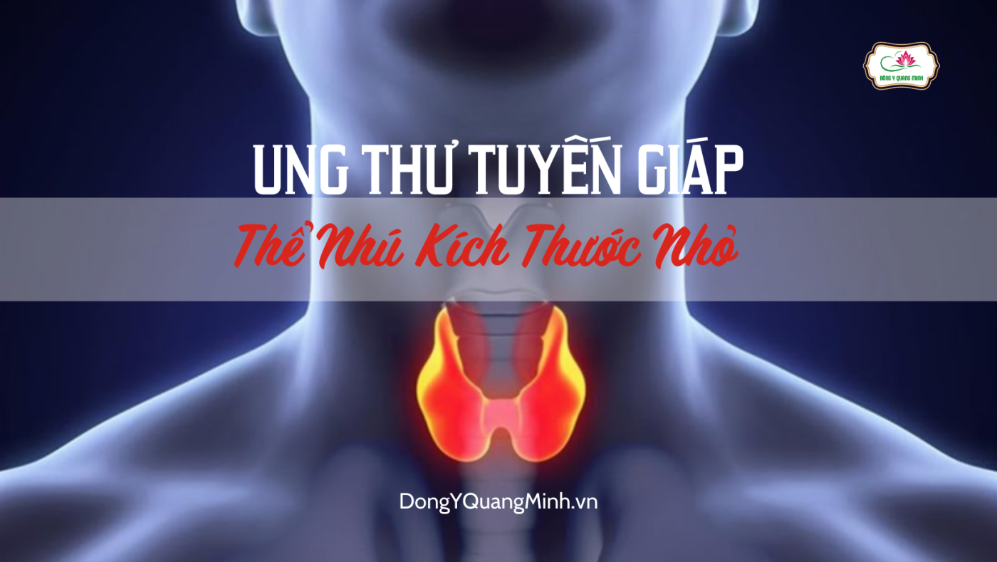 Ung Thư Tuyến Giáp