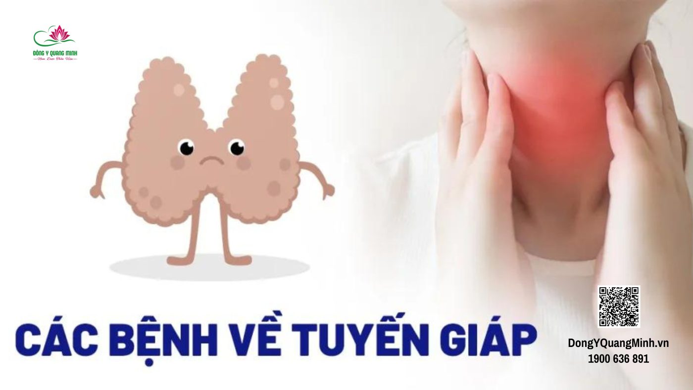các bệnh tuyến giáp