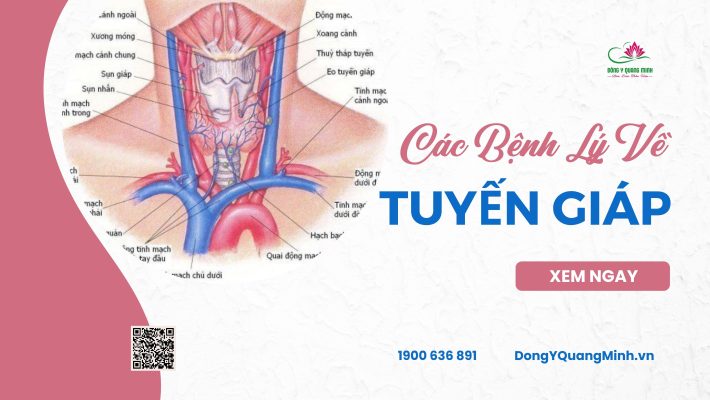 các bệnh tuyến giáp