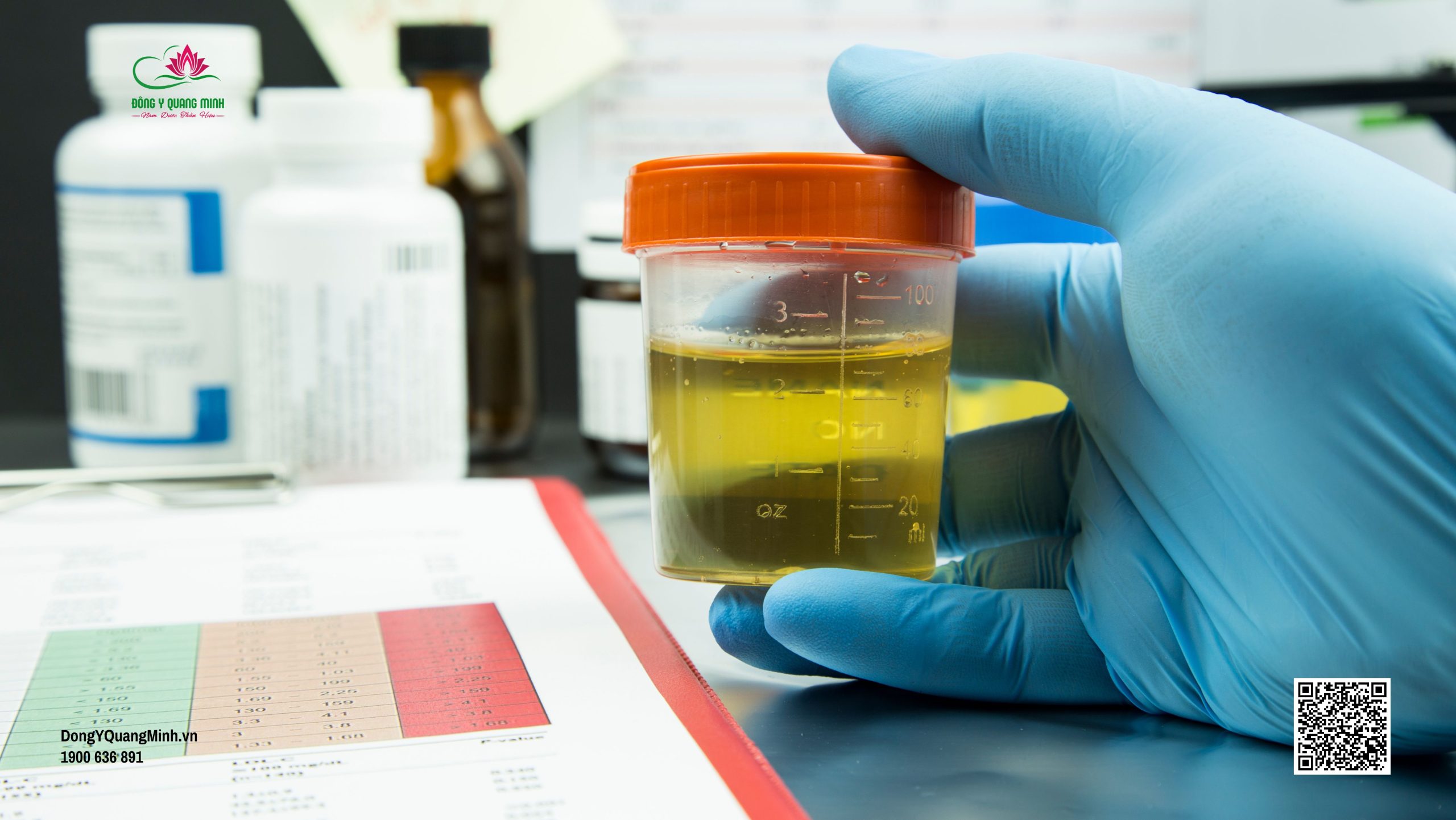 bàng quang tăng hoạt