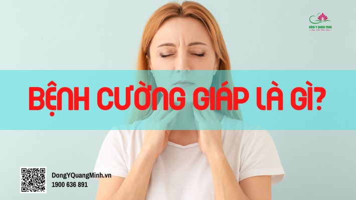 cường giáp