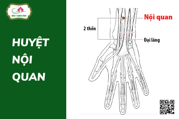 huyệt nội quan