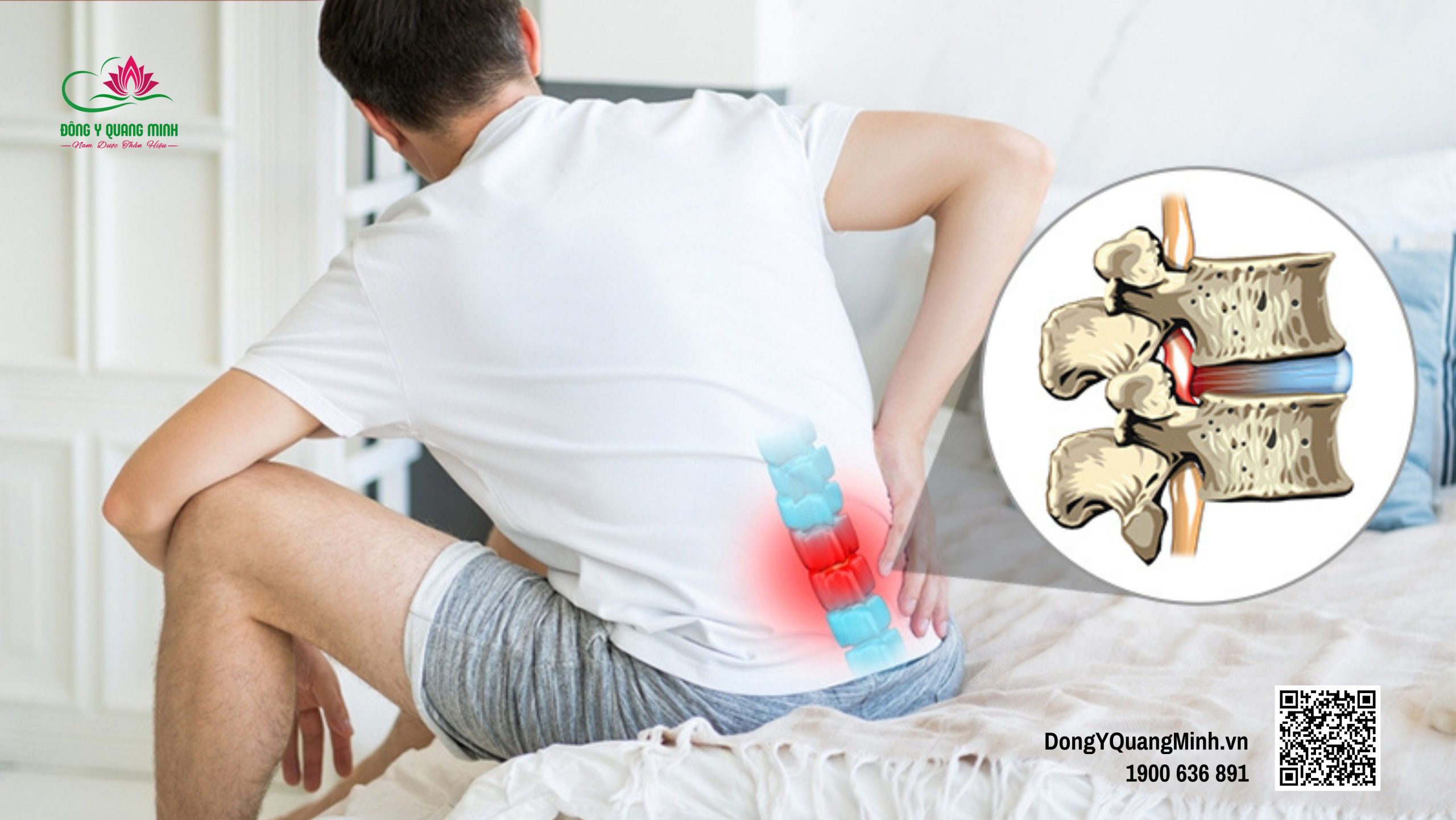 thoát vị đĩa đệm lưng