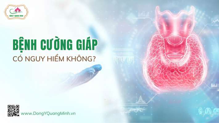 Bệnh Cường Giáp Có Nguy Hiểm Không?