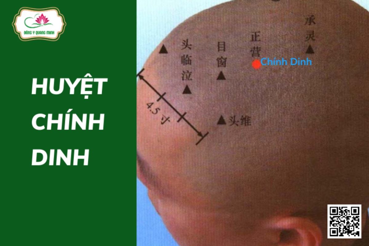 Vị Trí, Tác Dụng Của Huyệt Chính Dinh