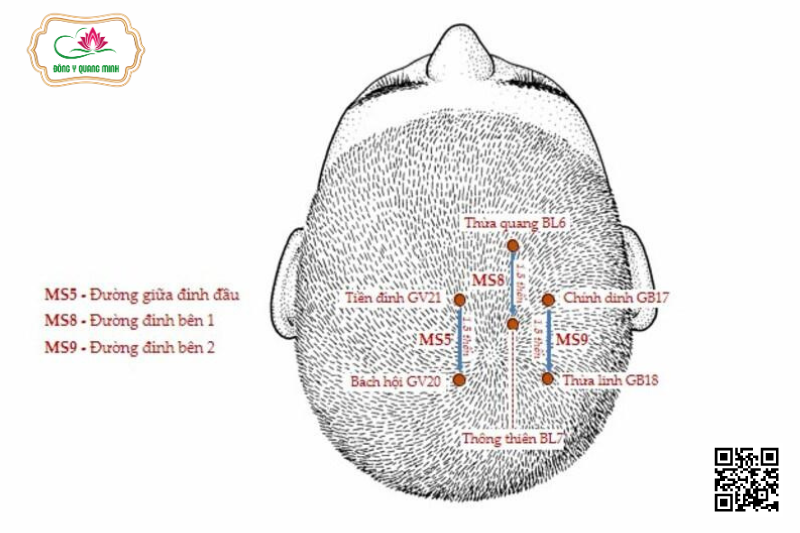 Vị Trí, Tác Dụng Của Huyệt Chính Dinh