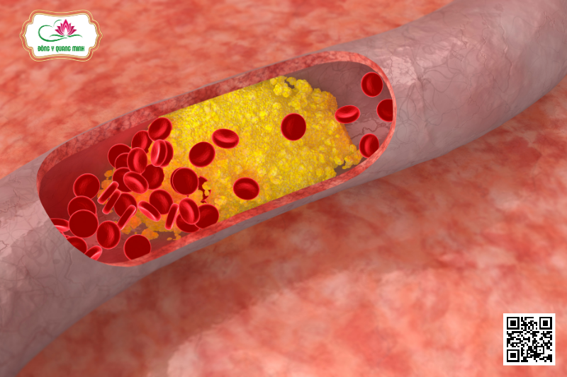 Vị Thuốc Quý Nần Vàng (Nần Nghệ)