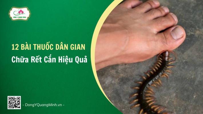 Chữa Rết Cắn Hiệu Quả Bằng 12 Bài Thuốc Dân Gian