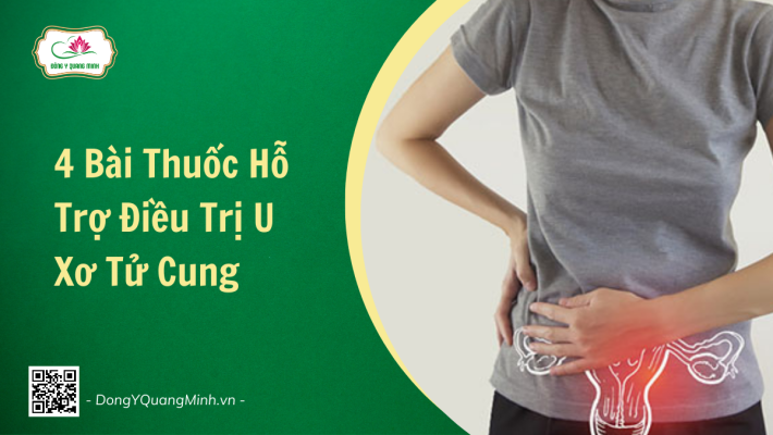 Bài Thuốc Hỗ Trợ Điều Trị U Xơ Tử Cung