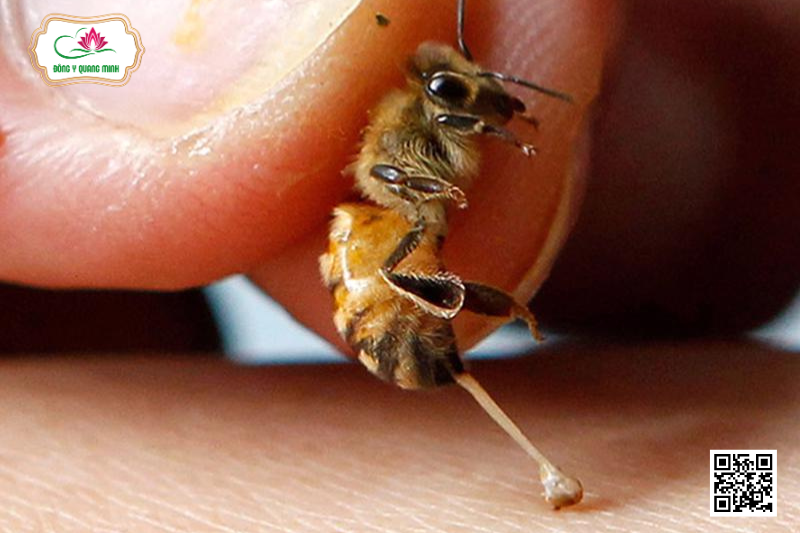 Nọc Ong - Đặc Điểm, Công Dụng Và Liều Dùng