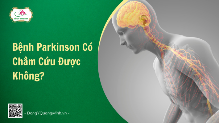 Bệnh Parkinson Có Châm Cứu Được Không?