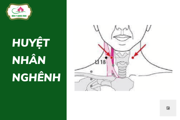 huyệt Nhân Nghênh