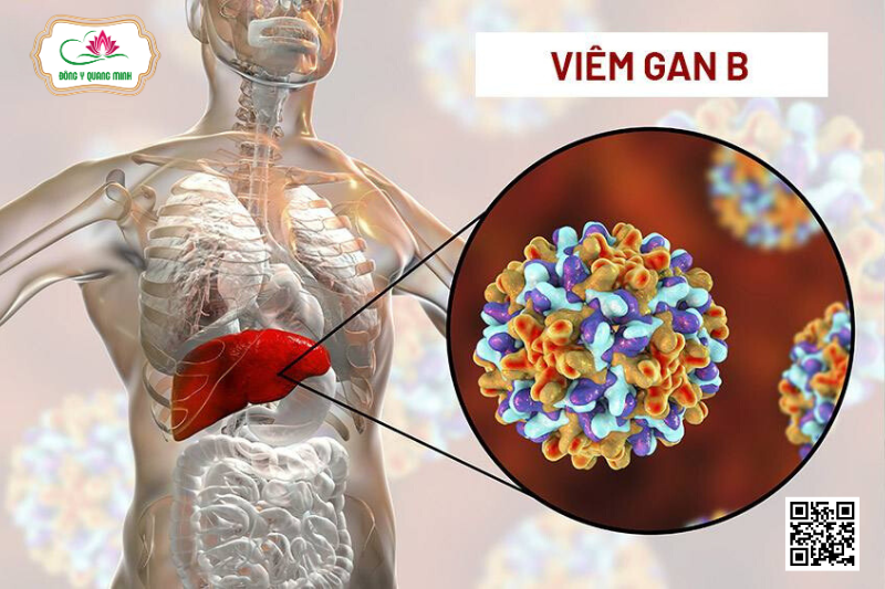 Bài Thuốc Đông Y Chữa Bệnh Viêm Gan B