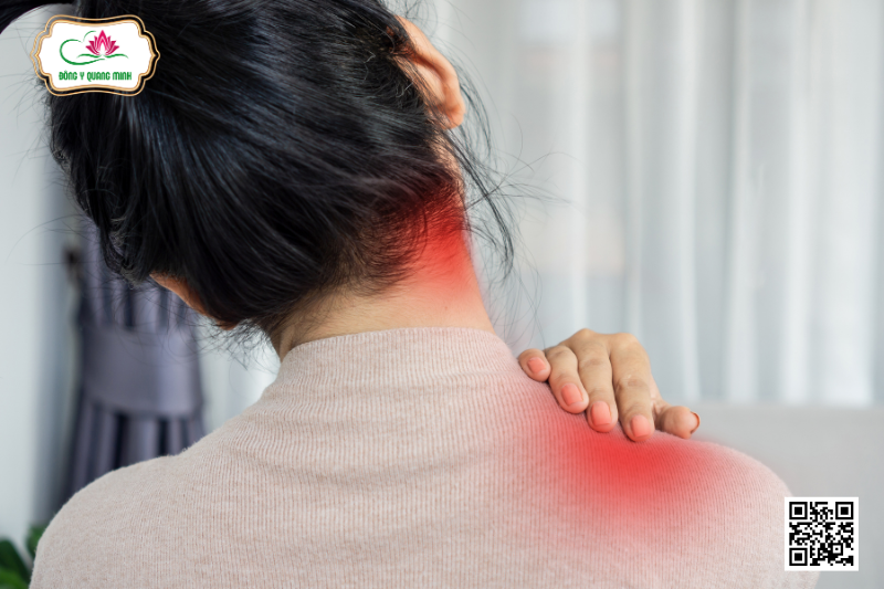 Điều Trị Đau Cổ Vai Gáy Ở Dân Văn Phòng Bằng Y Học Cổ Truyền