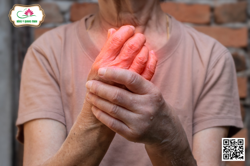 Cần Làm Gì Khi Viêm Khớp Tái Phát Vào Mùa Đông?