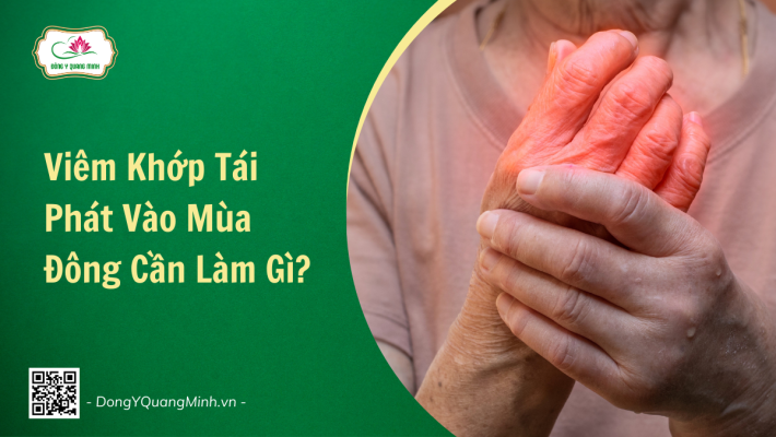 Cần Làm Gì Khi Viêm Khớp Tái Phát Vào Mùa Đông?